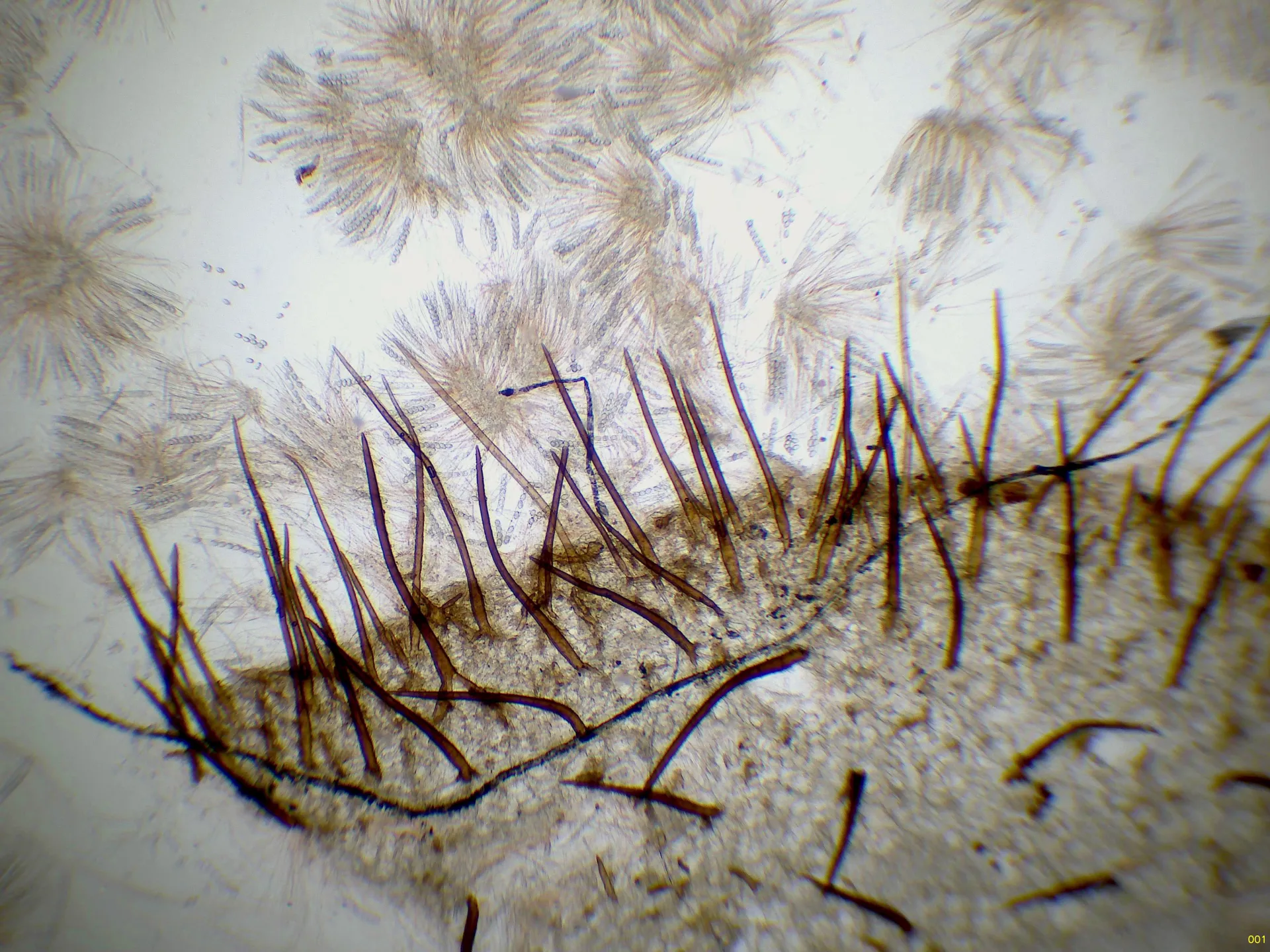 Microscopía de Scutellinia vitreola - 11 - Pelos x 40-001